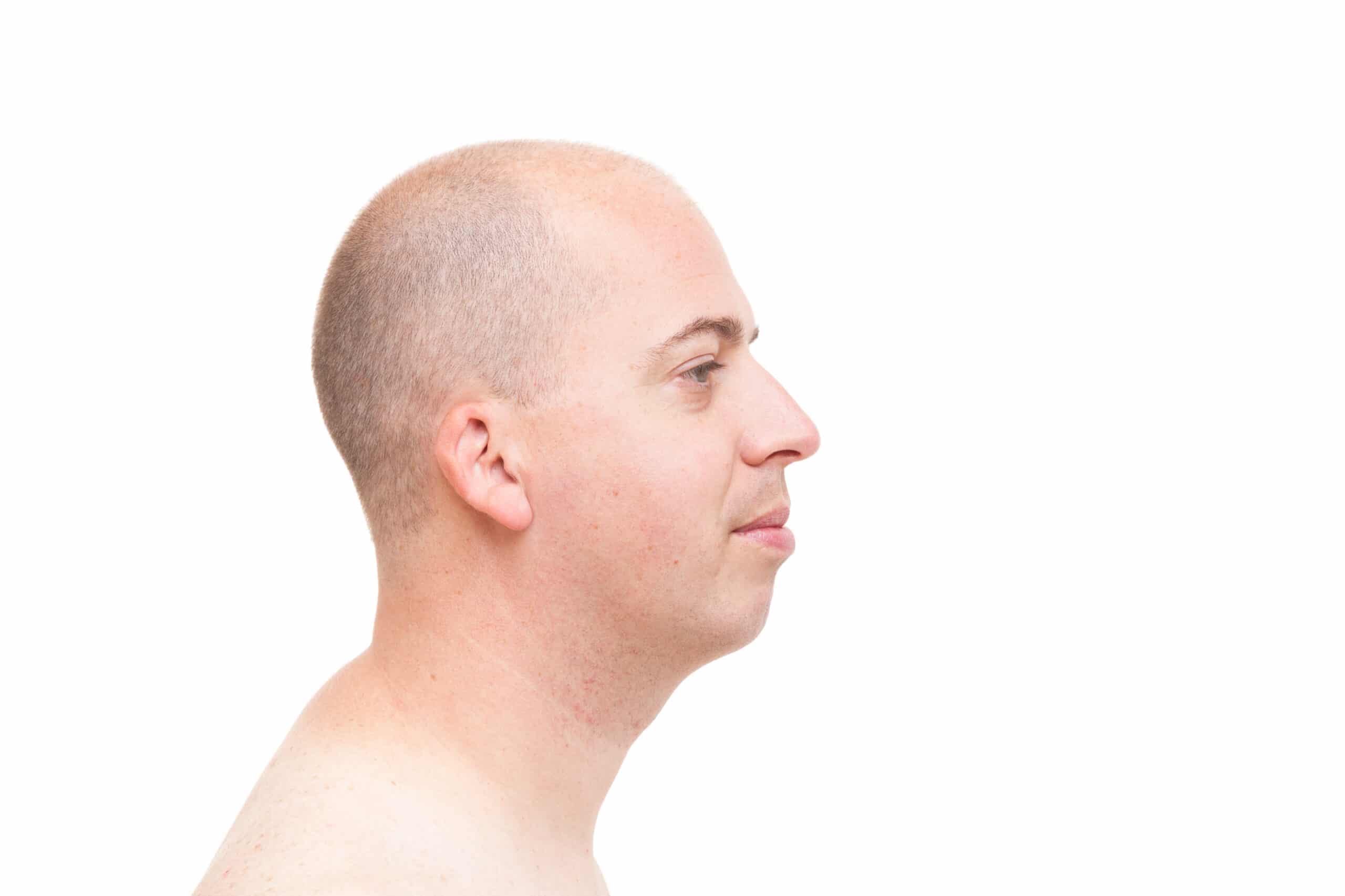 Voor