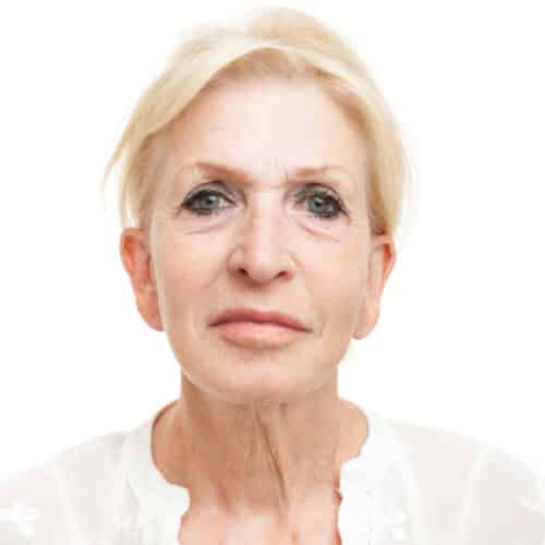 Liquid Facelift Na