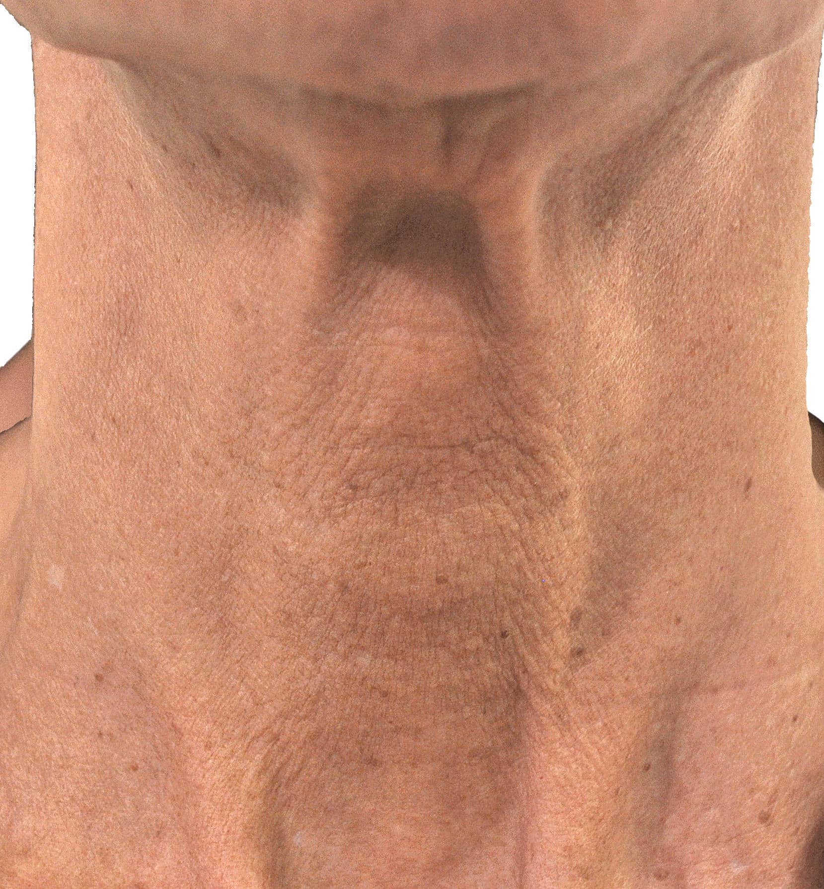 Voor